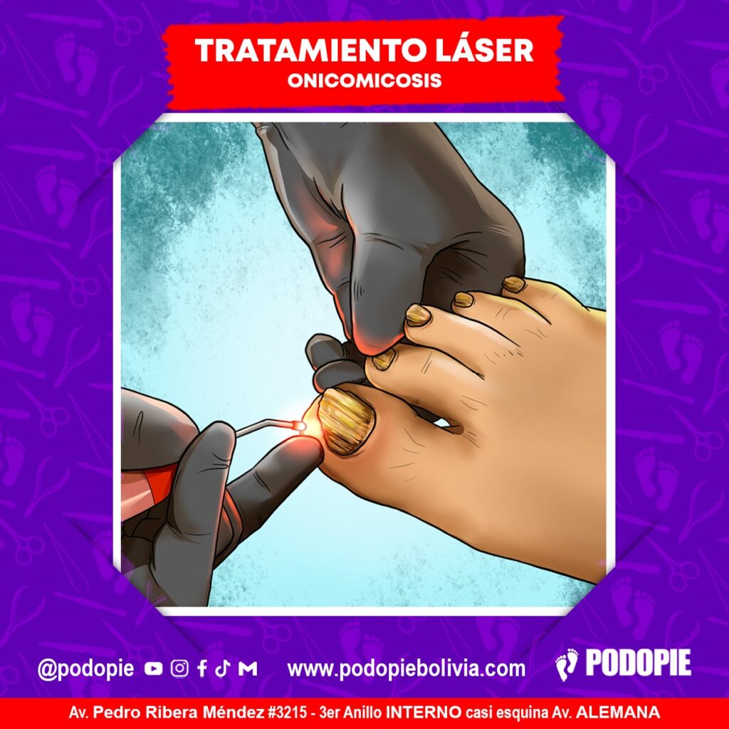 Atención Podopie