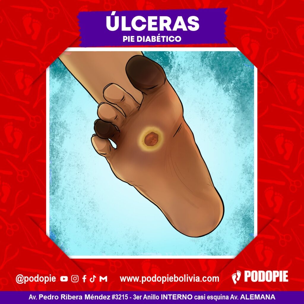 Atención Podopie