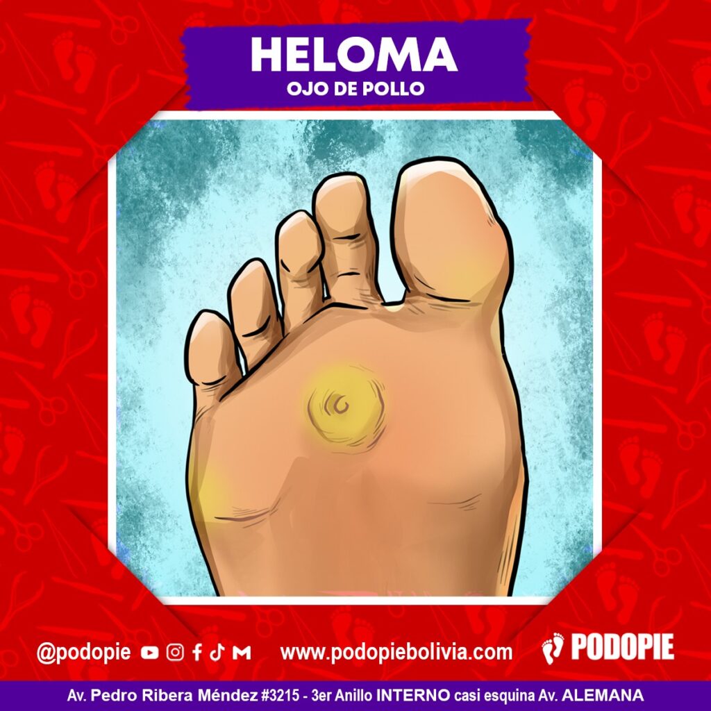 Atención Podopie