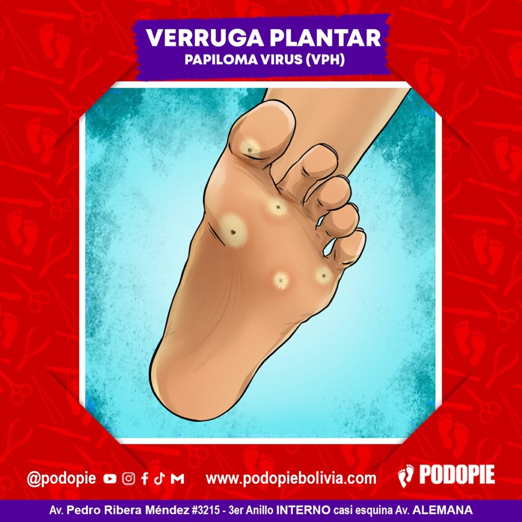 Atención Podopie