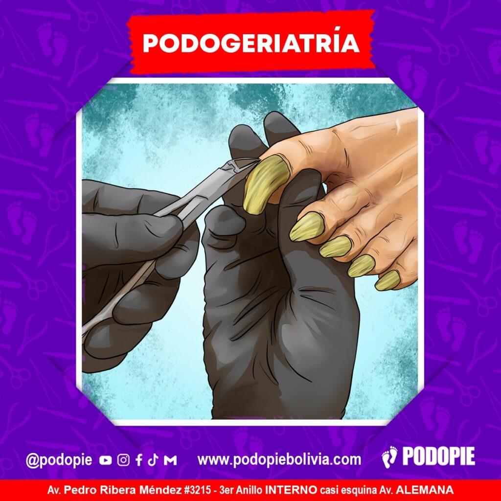 Atención Podopie