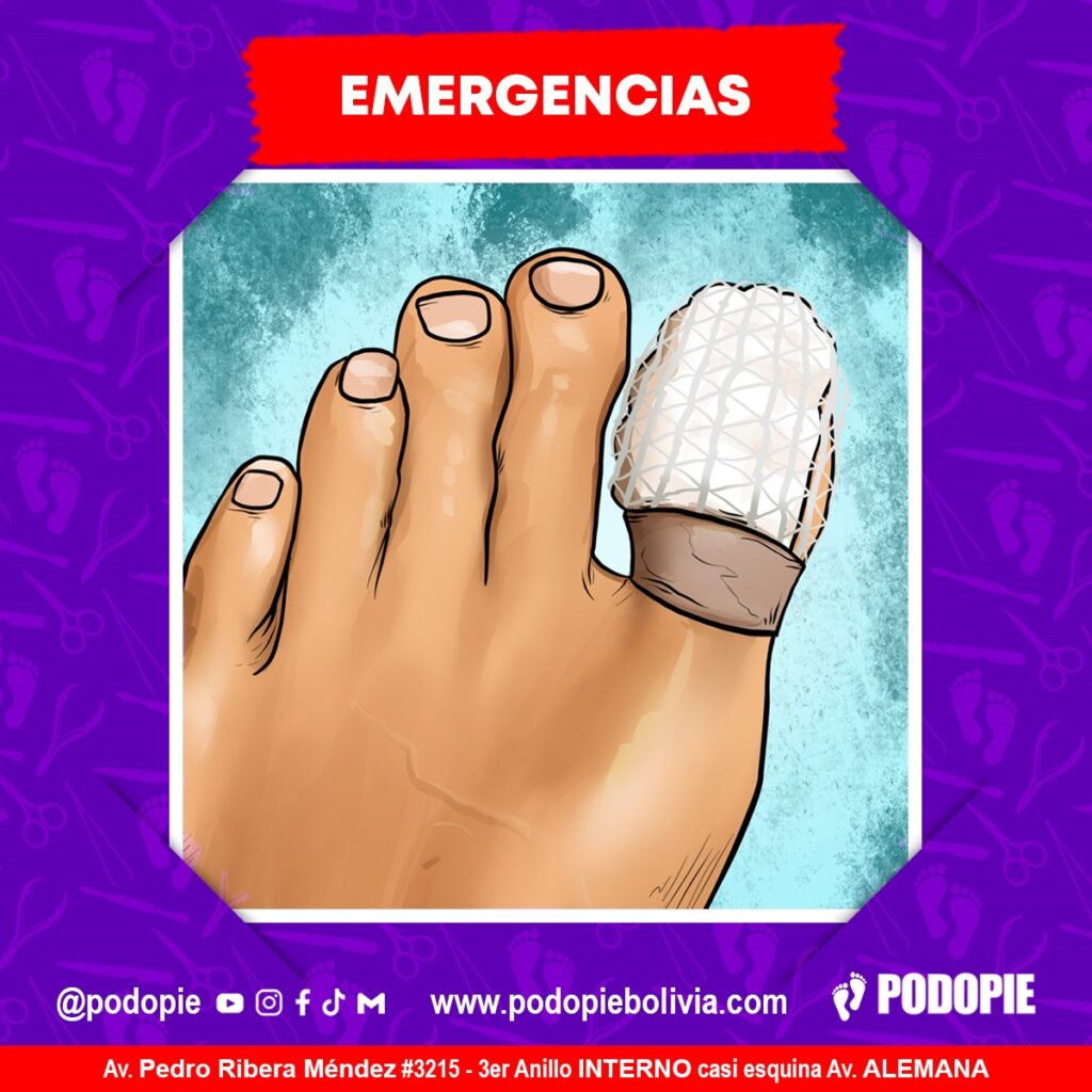 Atención Podopie