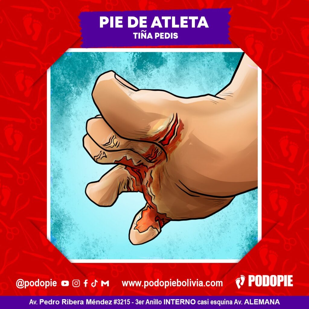 Atención Podopie