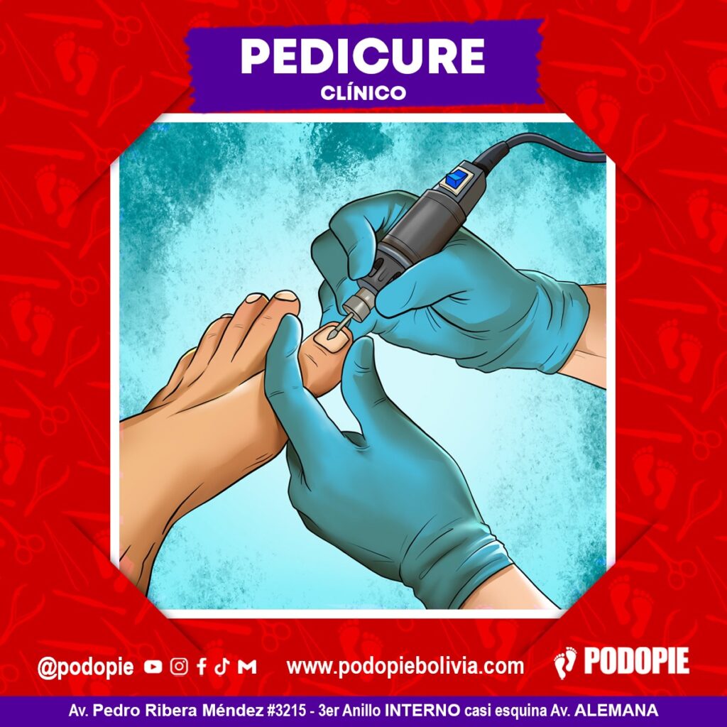 Atención Podopie