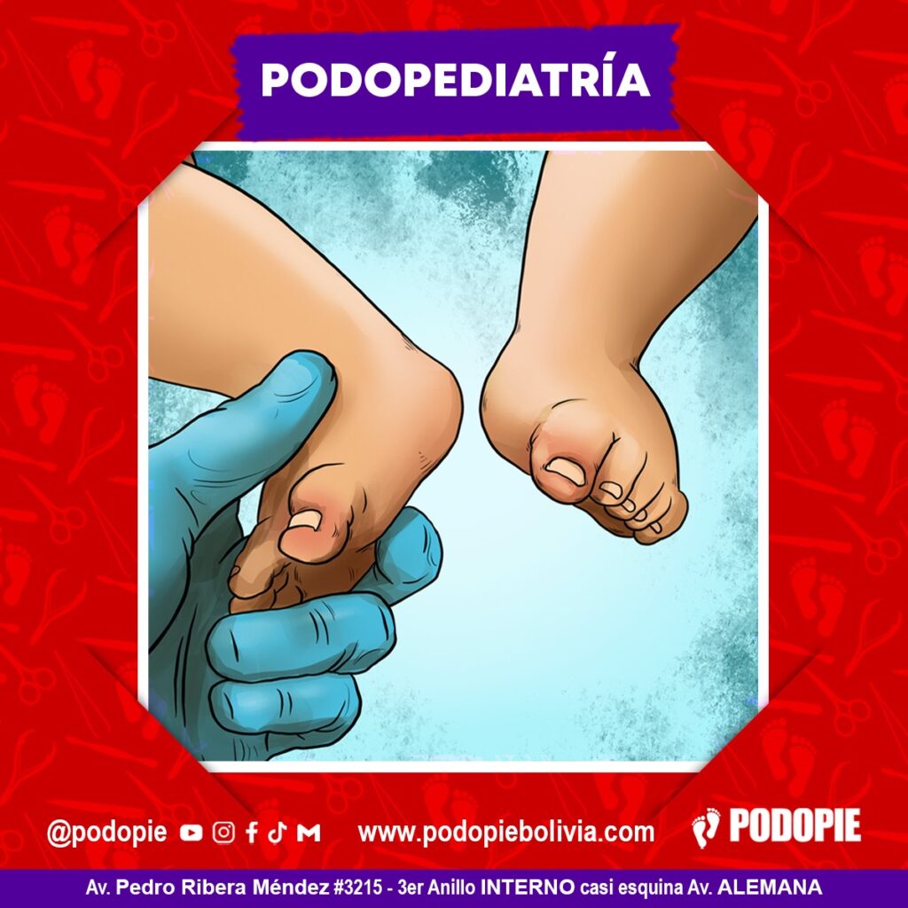 Atención Podopie